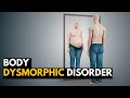 BODY DYSMORPHIC DISORDER (BDD), Causes, Signs and Symptoms, Diagnosis and Treatment