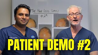 Patient Demonstration #2 | The Hair Loss Show