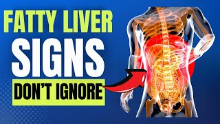 5 Warning Signs of A Silent Threat: Fatty Liver Disease! | Health Over 50