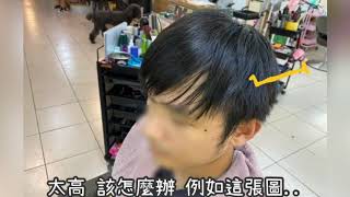男生髮線太高怎麼辦？