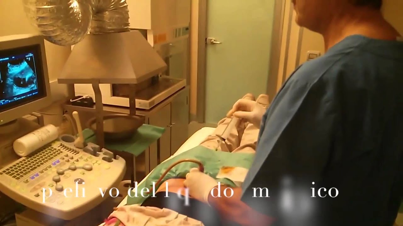 Amniocentesi in Altamedica - Prof. Claudio Giorlandino
