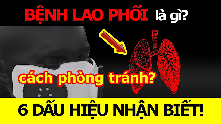 Phong lao cổ lại là gì năm 2024