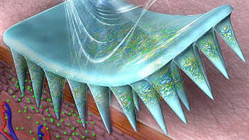 Microneedle-Array Patch with Enzyme-Free Polymeric Components for On-Demand Insulin Delivery