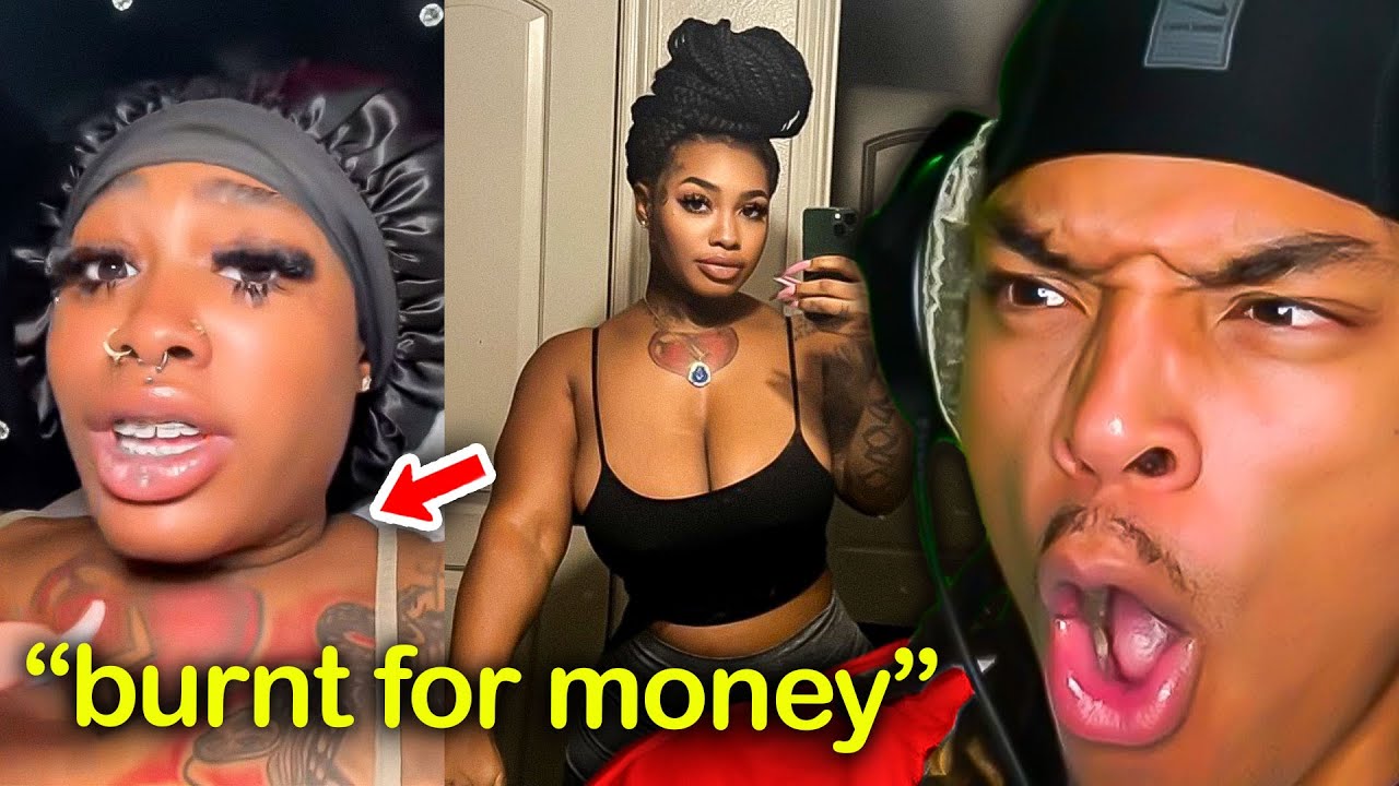 He Burned All The Strippers At The Club On Purpose...