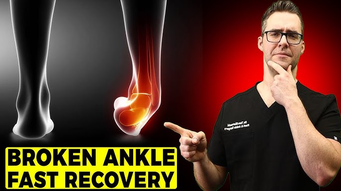 Ankle Fracture Treatment - Recovery Time & Exercises 