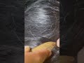 #fypviralシ #kutu #statisfying #satisfying #fyppppppppppppppppppppppp #kuturambut #india #xyzbcafypシ