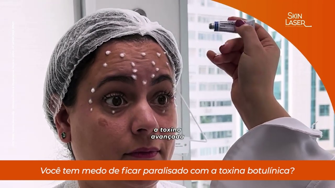 Você tem medo de ficar paralizado com a TOXINA BOTULÍNICA?