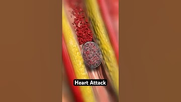 Heart Attack (3D Animation)