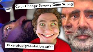 This $16,000 Eye Color Surgery is Dangerous