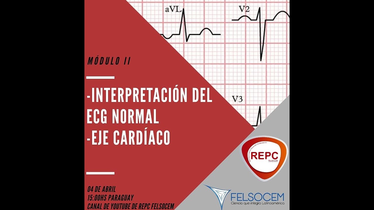MÓDULO II Fisiología del ECG