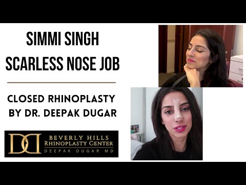 Video thumbnail: Scarless Nose Rhinoplasty with Simmi Singh - Dr. Dugar, Beverly Hills