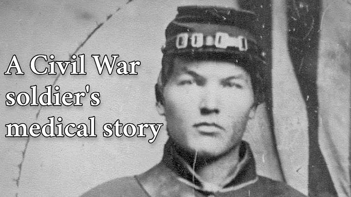 Letters From War – Private Peleg Bradford and Civil War Medicine - DayDayNews