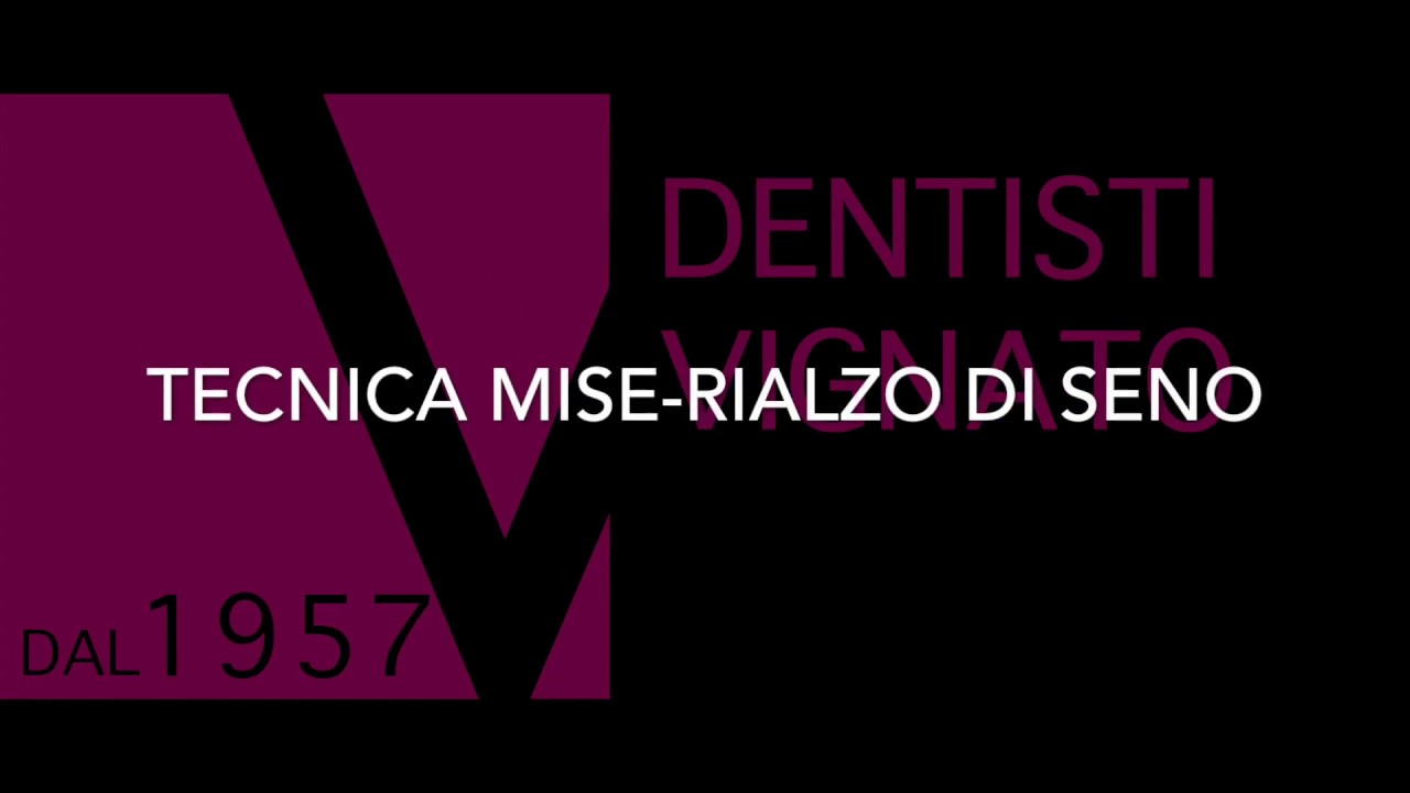 Utilizzo del kit MISE per il rialzo del seno mascellare