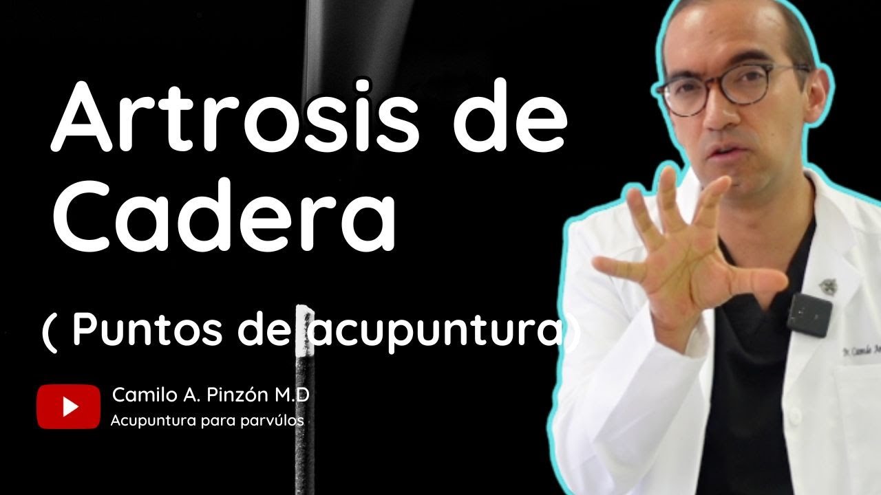 ARTROSIS DE CADERA 🦴: puntos de acupuntura | Acupuntura para párvulos.