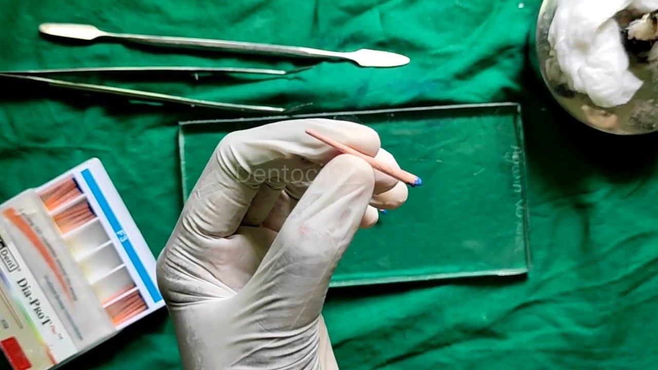 Customized Cone Obturation Technique Demonstration | Roll Cone Technique | Dr. Agwin