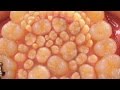 【奇病】過剰歯症 ~無数に並ぶ歯~【閲覧注意】