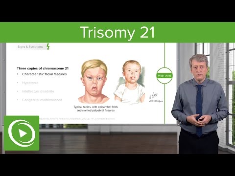 Trisomy 21 (Down Syndrome): Introduction – Pediatrics | Lecturio