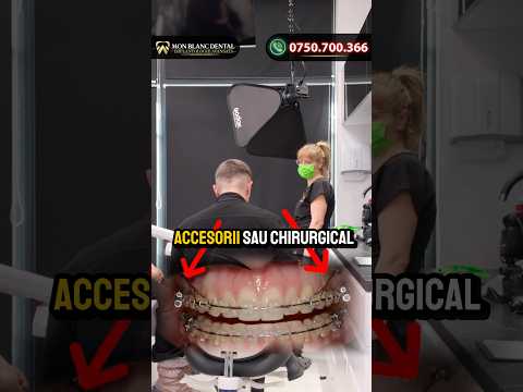 Chirurgia ortognata îți poate salva zâmbetul dorit!