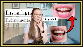 Invisalign Refinements Update (18 months later) | Cracked Tray, Stained Tooth, Gums & Bite