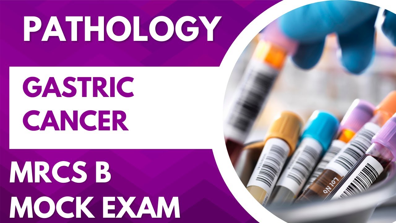 MRCS B  | PATHOLOGY  | GASTRIC CANCER  MOCK