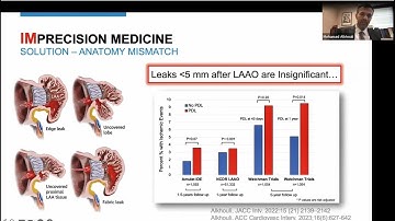 "Wired for Precision: How AI is Rewriting the Cath Lab Blueprint”