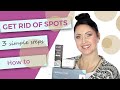 How do I get rid of: brown spots | dark spots | age spots | pigmentation?