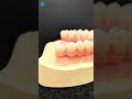 zirconia arches.#dental #zirconia #denture