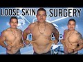 Plans For Loose Skin Surgery