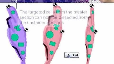 Laser Microdissection: Serial Section
