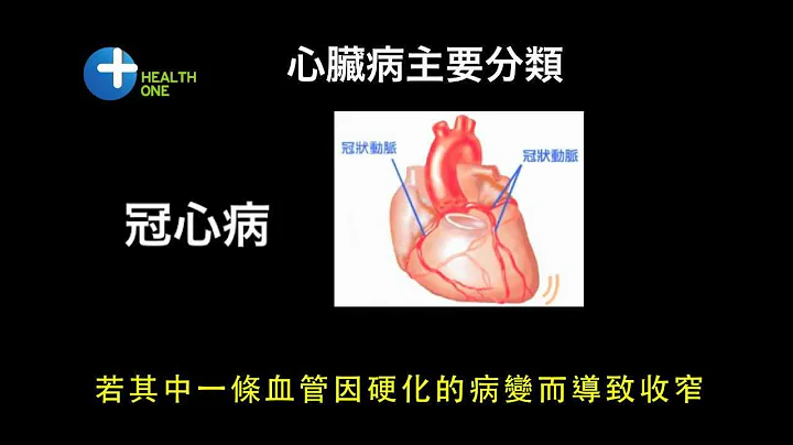 冠心病 (Coronary Heart Disease) - 天天要聞