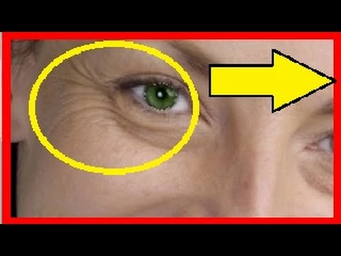 Como quitar los ojos rojos