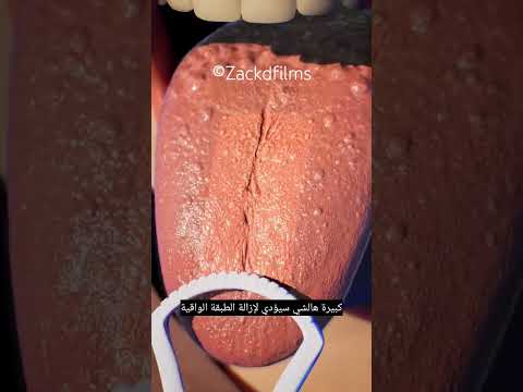 كيف تجري عملية كشط اللسان
