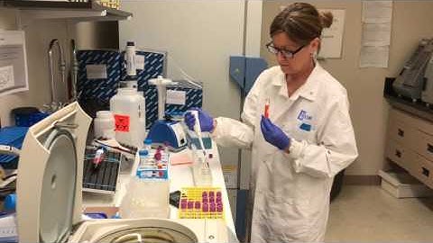 What tests do you do to match donors with recipients?