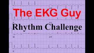 EKG/ECG - Rhythm Challenge 9.0 | The EKG Guy