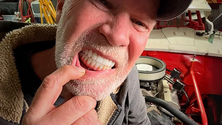 GOOD & BAD of my Dental Implants After 6 Months