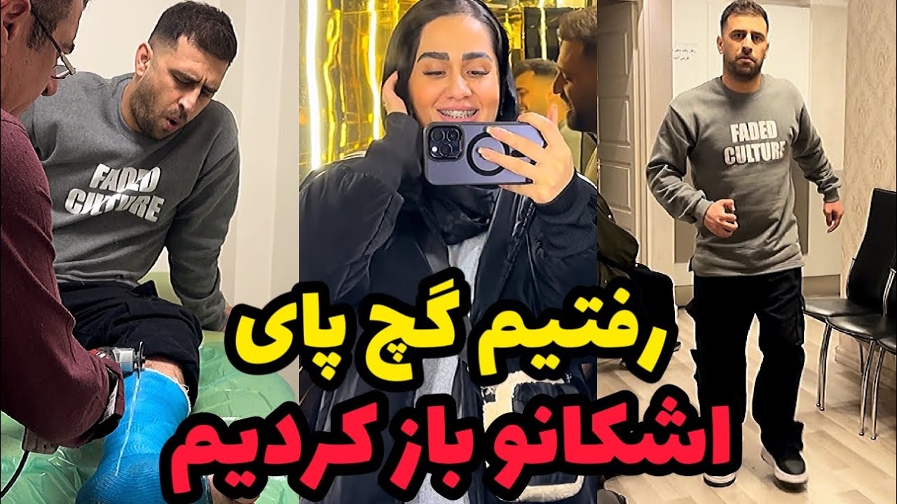 بالاخره گچ پای اشکانو باز کردیم😍❤️