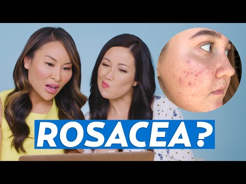 Acne Rosacea Skincare Routine for Anna! | #SKINCARE