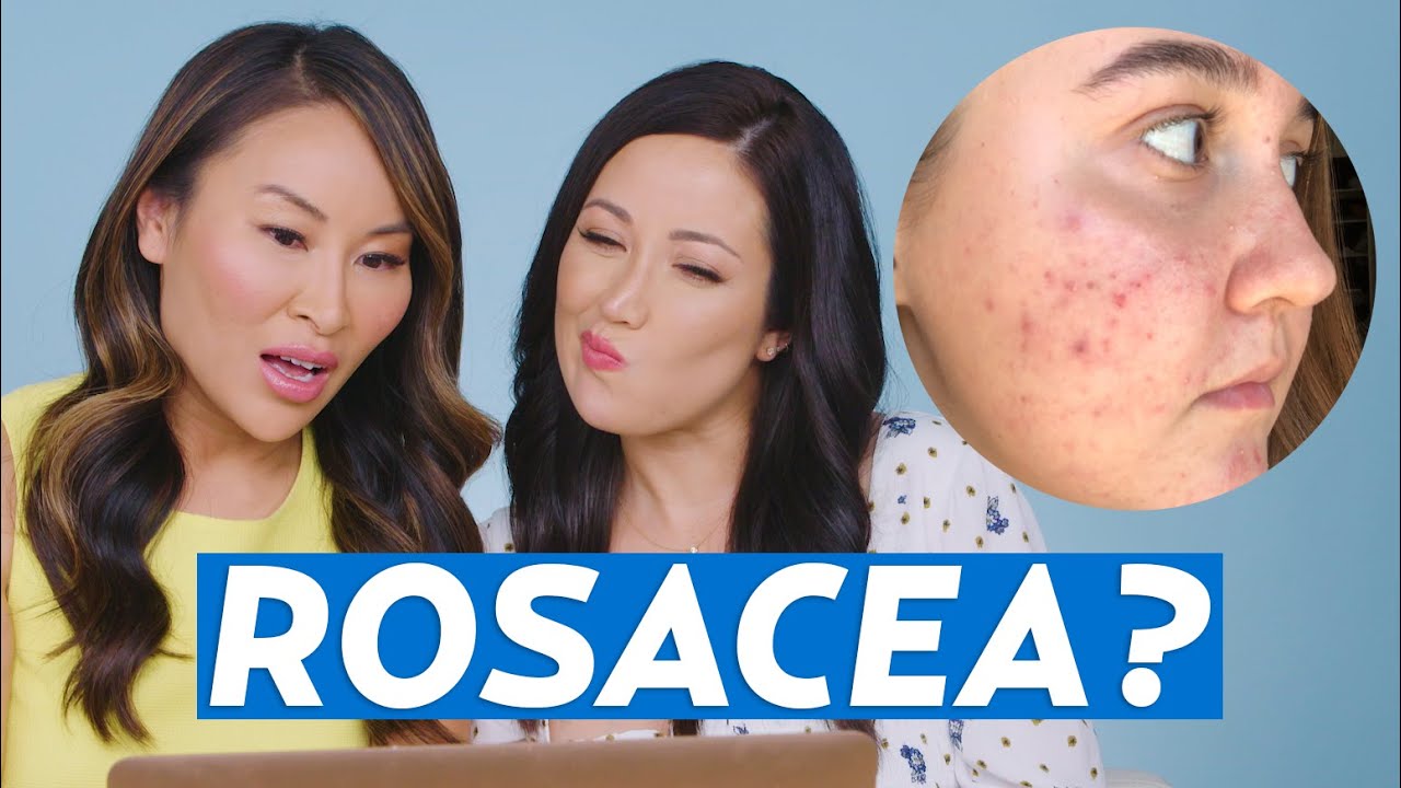 face routine for rosacea