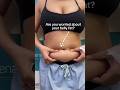 Before vs After liposuction #plasticsurgery #liposuction