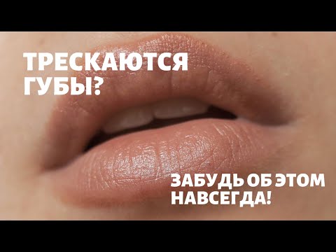 Трескаются губы? Пора забыть об этой проблеме. Дешево и действенно!