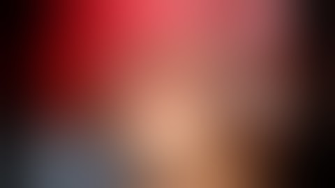 4 live surgery wce 2003