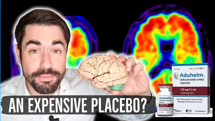 The New Dementia Drug that Doesn't Work? | Biogen's Aducanumab (Aduhelm) - DayDayNews
