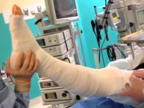 Vidéo: Ce Que Vous Devez Savoir Sur Le Bandage Postopératoire