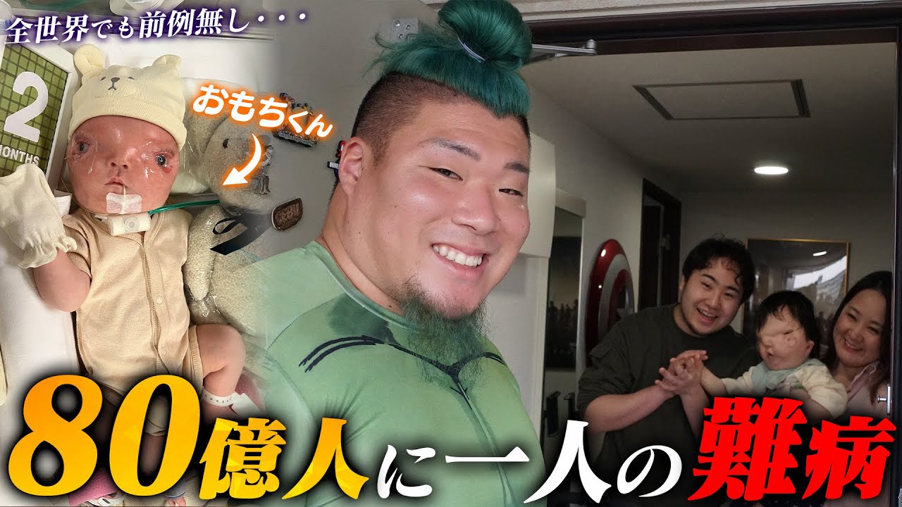 1 in 8 billion] A close look at Omochi-kun, a man battling an