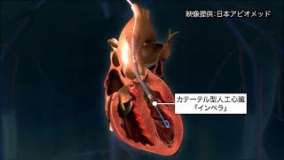 beyond ~掴め!未来のチカラ~ 第2回「バイオ・メディカル」