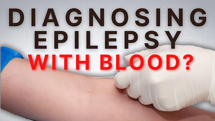 A New Way to Diagnose Epilepsy (does it work for everyone?)