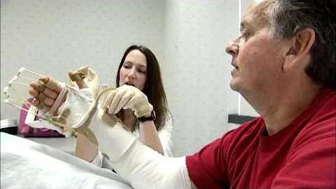 Hand Transplant Patient Ronald Thurman Hand Therapy