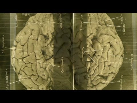 Images of Einstein's brain revealed - YouTube