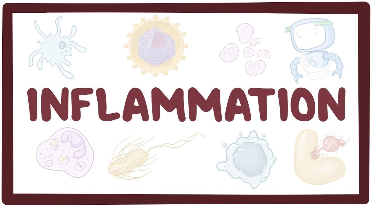 Inflammation - Causes, Symptoms, Diagnosis, Treatment, Pathology