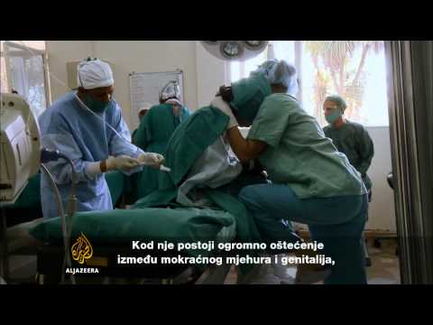 Video: Kako se dijagnosticira perilimfna fistula?